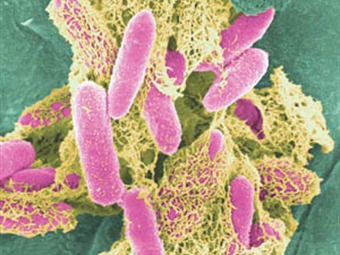 Noticia Radio Panamá | Francia confirma primer caso de afectado por bacteria E.coli