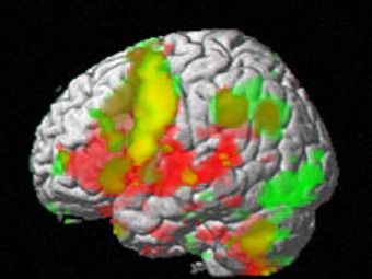 Featured image for “Nuevo tratamiento del autismo mediante la investigación genética y el escáner en 3D”