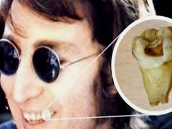 Noticia Radio Panamá | Un dentista quiere clonar a John Lennon por su diente