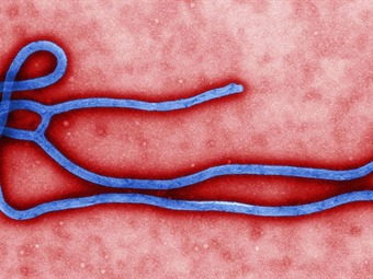 Noticia Radio Panamá | Auxiliar de enfermería está cuarada de ébola