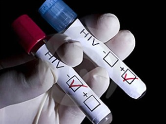 Noticia Radio Panamá | Es posible hallar cura de VIH con nuevas investigaciones, según científicos