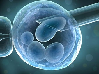 Noticia Radio Panamá | Fabrican estructuras renales embrionarias a partir de células madre humanas