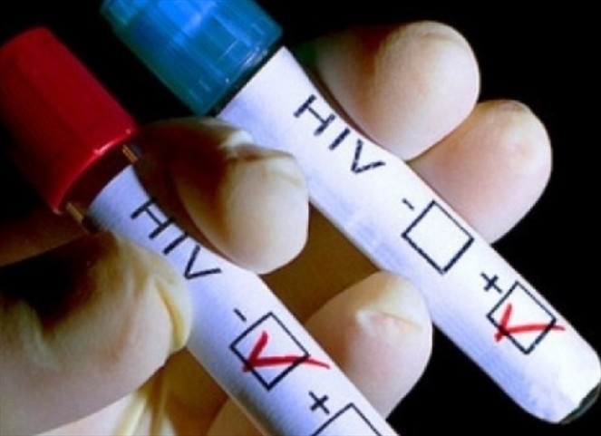 Noticia Radio Panamá | Científicos crean vacuna para combatir el virus del VIH