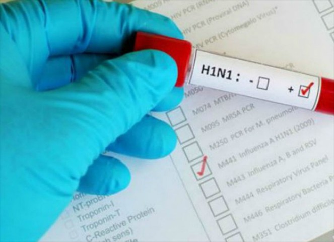 Noticia Radio Panamá | Se registran 11 muertes en Colombia por causa del vírus AH1N1