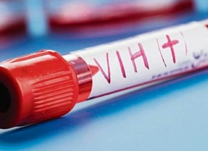 Noticia Radio Panamá | Baja número de pacientes nuevos detectados con VIH en lo que va del año