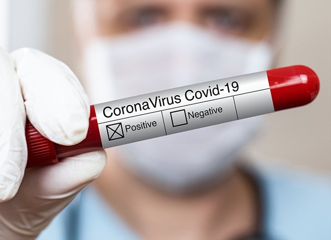 Noticia Radio Panamá | Aumenta cifra por coronavirus, 3.015 casos positivos y 23 nuevas defunciones