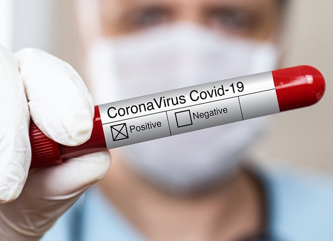 Noticia Radio Panamá | Panamá reporta 179 casos positivos y 6,138 defunciones acumuladas por coronavirus