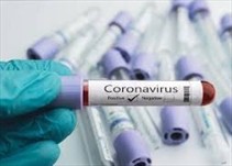 Noticia Radio Panamá | Panamá reporta 279 casos positivos y 3 nuevas defunciones por coronavirus