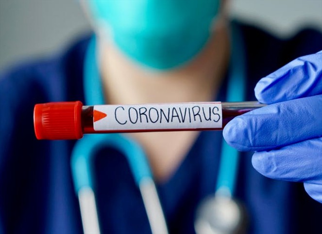 Noticia Radio Panamá | MINSA reporta 419 casos positivos y 2 nuevas defunciones por coronavirus