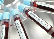 Noticia Radio Panamá | Panamá reporta 314 casos positivos y 2 nuevas defunciones para un total de 6,198 acumuladas por coronavirus