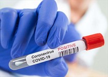 Noticia Radio Panamá | Panamá registra 320 casos positivos y 4 nuevas defunciones por coronavirus