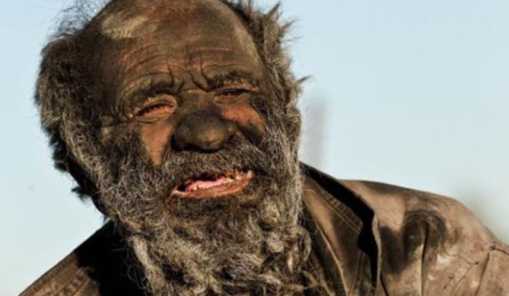 Murió a los 94 años el «hombre más sucio del mundo»: Se había bañado hace solo un par de meses