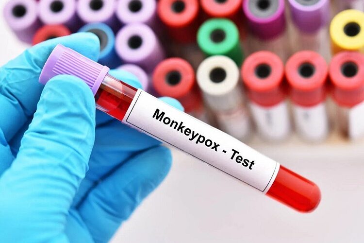 Monkeypox cases increase and there are 189 infections throughout the country